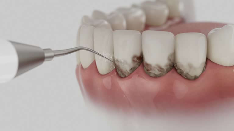 Trusted Teeth Cleaning And Checkup service in Chinchilla, PA - Dentist Open Now